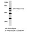 Protein Tyrosine Phosphatase Non-Receptor Type 11 antibody, LS-C176207, Lifespan Biosciences, Western Blot image 