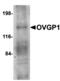 Mucin-9 antibody, A07911, Boster Biological Technology, Western Blot image 