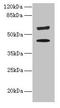Keratin 73 antibody, LS-C399018, Lifespan Biosciences, Western Blot image 