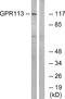 Adhesion G Protein-Coupled Receptor F3 antibody, A30798, Boster Biological Technology, Western Blot image 
