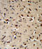 Tryptophan Hydroxylase 2 antibody, LS-C160137, Lifespan Biosciences, Immunohistochemistry paraffin image 