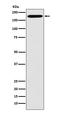 Clathrin Heavy Chain antibody, M03134, Boster Biological Technology, Western Blot image 