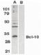 BCL10 Immune Signaling Adaptor antibody, orb86847, Biorbyt, Western Blot image 