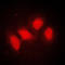 SMG7 Nonsense Mediated MRNA Decay Factor antibody, LS-C353204, Lifespan Biosciences, Immunofluorescence image 