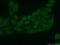 PIN2 (TERF1) Interacting Telomerase Inhibitor 1 antibody, 12368-1-AP, Proteintech Group, Immunofluorescence image 