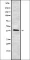 Lysophosphatidic Acid Receptor 6 antibody, orb336445, Biorbyt, Western Blot image 