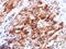 Glypican 3 antibody, AE00138, Aeonian Biotech, Immunohistochemistry paraffin image 