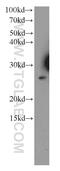 Tescalcin antibody, 11125-1-AP, Proteintech Group, Western Blot image 