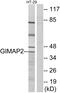 GTPase, IMAP Family Member 2 antibody, GTX87040, GeneTex, Western Blot image 