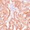 Ribose 5-Phosphate Isomerase A antibody, GTX66545, GeneTex, Immunohistochemistry paraffin image 