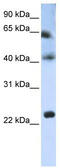 Tetraspanin 3 antibody, TA339023, Origene, Western Blot image 