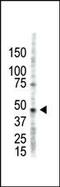 Protein Arginine Methyltransferase 2 antibody, GTX23763, GeneTex, Western Blot image 