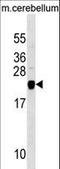 Transgelin 3 antibody, LS-C157132, Lifespan Biosciences, Western Blot image 