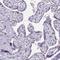 TEA Domain Transcription Factor 4 antibody, NBP2-33803, Novus Biologicals, Immunohistochemistry paraffin image 