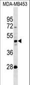 Keratin 31 antibody, LS-C160021, Lifespan Biosciences, Western Blot image 