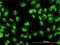 DExH-Box Helicase 9 antibody, H00001660-M01, Novus Biologicals, Immunofluorescence image 