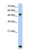 Radical S-Adenosyl Methionine Domain Containing 2 antibody, orb325033, Biorbyt, Western Blot image 