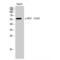 Estrogen Receptor 2 antibody, LS-C381160, Lifespan Biosciences, Western Blot image 