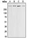 CREB Binding Protein antibody, MBS821917, MyBioSource, Western Blot image 