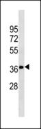 Fructosamine 3 Kinase antibody, LS-C203908, Lifespan Biosciences, Western Blot image 