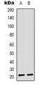 Anti-Silencing Function 1B Histone Chaperone antibody, LS-C368861, Lifespan Biosciences, Western Blot image 