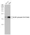 Eukaryotic Translation Initiation Factor 4E Binding Protein 1 antibody, GTX133181, GeneTex, Western Blot image 