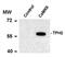 Tryptophan Hydroxylase 2 antibody, TA309262, Origene, Western Blot image 