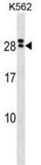 Interleukin 15 Receptor Subunit Alpha antibody, GTX53652, GeneTex, Western Blot image 