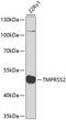 Transmembrane Serine Protease 2 antibody, 18-426, ProSci, Western Blot image 