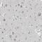 Cyclin Dependent Kinase 14 antibody, NBP1-80920, Novus Biologicals, Immunohistochemistry frozen image 