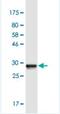 SRY-Box 5 antibody, H00006660-M01-100ug, Novus Biologicals, Western Blot image 