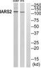 Isoleucyl-tRNA synthetase, mitochondrial antibody, TA315597, Origene, Western Blot image 
