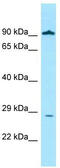 GLI Pathogenesis Related 1 antibody, TA338123, Origene, Western Blot image 