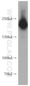 Myosin Heavy Chain 10 antibody, 21403-1-AP, Proteintech Group, Western Blot image 