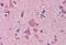 Necdin, MAGE Family Member antibody, MBS245716, MyBioSource, Immunohistochemistry paraffin image 