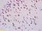 Smoothened, Frizzled Class Receptor antibody, GTX60154, GeneTex, Immunohistochemistry paraffin image 