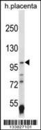 HIF-2-alpha antibody, 57-549, ProSci, Western Blot image 