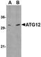 Autophagy Related 12 antibody, orb74923, Biorbyt, Western Blot image 