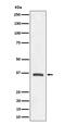 Oxoglutarate Receptor 1 antibody, M12225, Boster Biological Technology, Western Blot image 