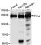 Protein Tyrosine Kinase 2 antibody, MBS125027, MyBioSource, Western Blot image 