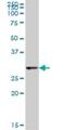 Peroxisomal Biogenesis Factor 26 antibody, H00055670-B01P, Novus Biologicals, Western Blot image 