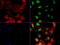 Nibrin antibody, LS-C799242, Lifespan Biosciences, Immunofluorescence image 