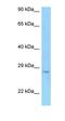 Serine Protease 58 antibody, orb326421, Biorbyt, Western Blot image 