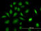 Phosphoribosylglycinamide Formyltransferase, Phosphoribosylglycinamide Synthetase, Phosphoribosylaminoimidazole Synthetase antibody, LS-B4319, Lifespan Biosciences, Immunofluorescence image 