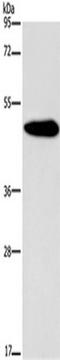 Potassium Voltage-Gated Channel Modifier Subfamily G Member 2 antibody, TA351315, Origene, Western Blot image 
