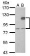 Suv3 Like RNA Helicase antibody, GTX628260, GeneTex, Western Blot image 