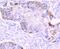 Matrix Metallopeptidase 13 antibody, NBP2-66954, Novus Biologicals, Immunohistochemistry paraffin image 