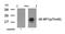 Eukaryotic Translation Initiation Factor 4E Binding Protein 1 antibody, GTX50259, GeneTex, Western Blot image 