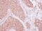 Siah E3 Ubiquitin Protein Ligase 1 antibody, NBP2-20356, Novus Biologicals, Immunohistochemistry paraffin image 