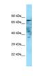 Golgi Integral Membrane Protein 4 antibody, orb325308, Biorbyt, Western Blot image 